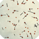 A photomicrographic view of Clostridium tetani, the bacteria that causes tetanus. Their tennis racket-like appearance is seen when the rod-shaped bacteria starts turning into a hardy spore.